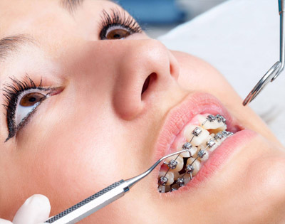 Jak wygląda leczenie&nbsp;ortodontyczne?